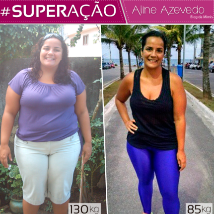 Antes e depois — Aline A. perdeu -45kg em 8 meses