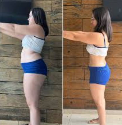 Antes e depois — Mariana S. perdeu -12kg em 3 meses