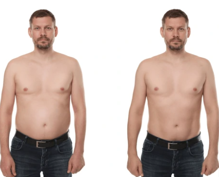 Antes e depois — Carlos M. perdeu -15kg em 4 meses
